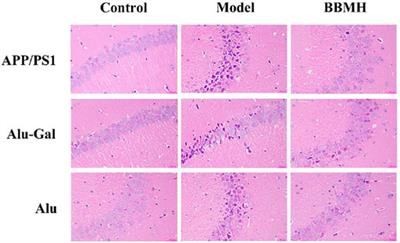 Prominent Effects of Berbamine Hydrochloride on Alzheimer’s Disease Model Mice